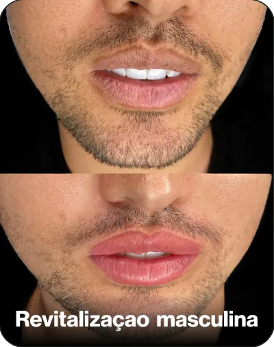 Resultado de técnica — cartela de cores 1