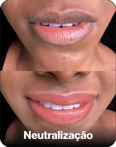 Resultado de técnica — cartela de cores 3