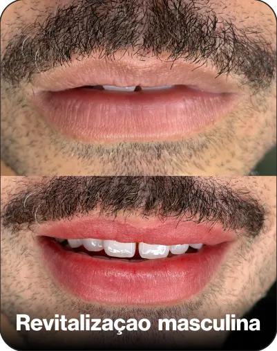 Resultado de técnica — cartela de cores 6