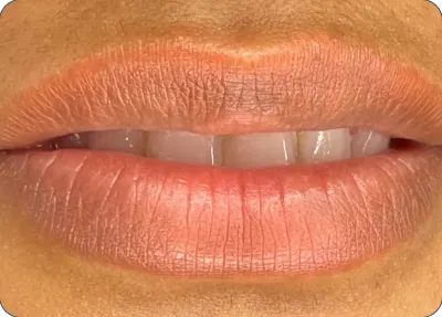 Resultado com tom alaranjado saturado, descolado do natural