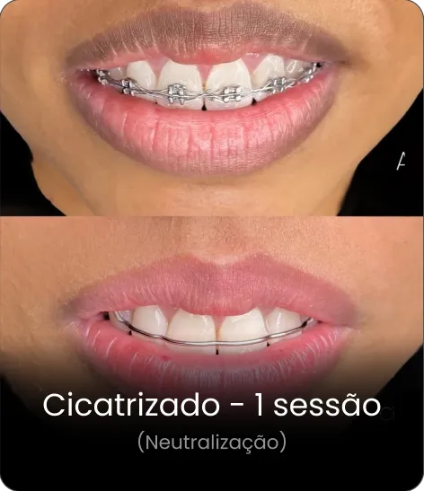 Resultado cicatrizado 2