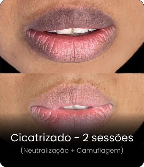 Resultado cicatrizado 4