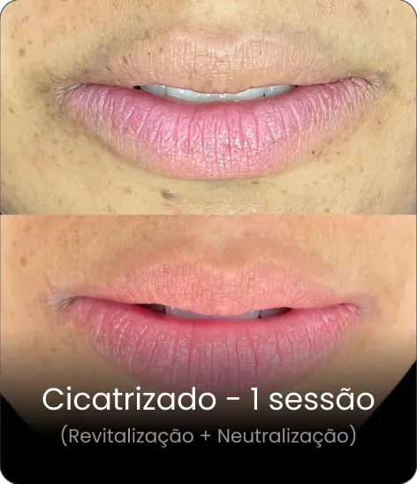 Resultado cicatrizado 5