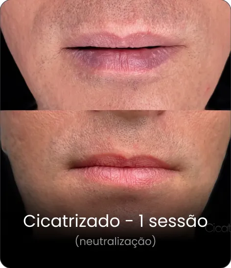 Resultado cicatrizado 6