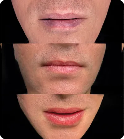 Evolução do retoque: sessão 1, retoque e resultado final