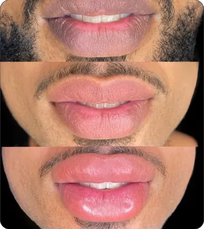 Evolução do retoque: sessão 1, retoque e resultado final